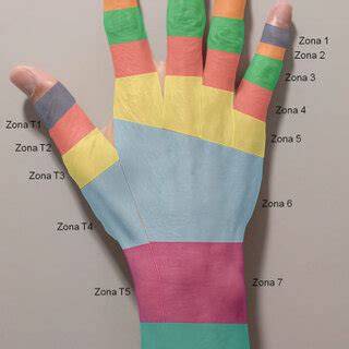 Diagrama de tendones y zonas extensores