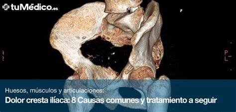 diagnóstico y tratamiento del dolor en la cresta ilíaca