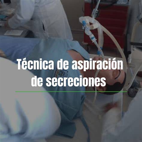 ilustración de modos de aspiración y control