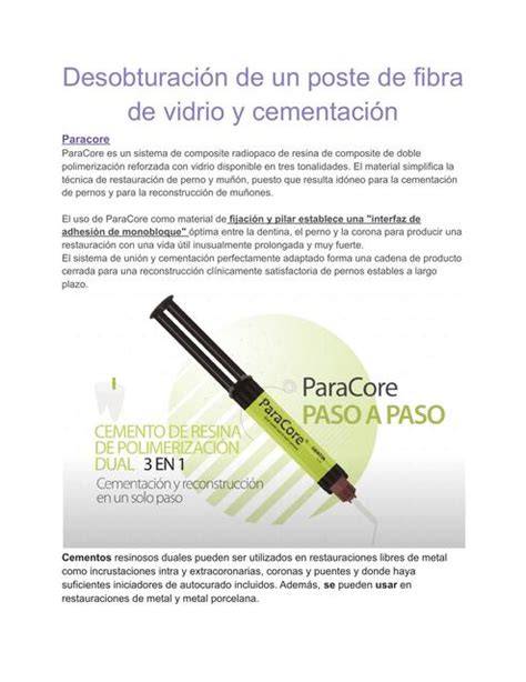 Esquema de colocación de poste de fibra de vidrio